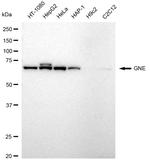 GNE Antibody in Western Blot (WB)