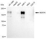 MERTK Antibody in Western Blot (WB)