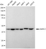 ADSS Antibody in Western Blot (WB)