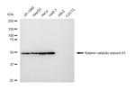 KATNA1 Antibody in Western Blot (WB)