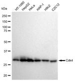 CDK4 Antibody in Western Blot (WB)