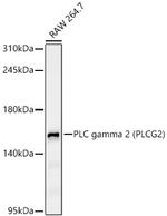 PLCG2 Antibody in Western Blot (WB)