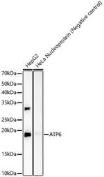 MT-ATP6 Antibody in Western Blot (WB)