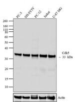 CDK5 Antibody in Western Blot (WB)