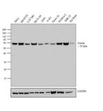 Fascin Antibody in Western Blot (WB)