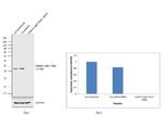 Clathrin Light Chain Antibody in Western Blot (WB)