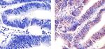 p53 Antibody in Immunohistochemistry (Paraffin) (IHC (P))