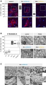 ICAM-1 Antibody in Immunocytochemistry (ICC/IF)