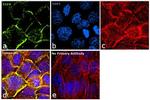 EGFR Antibody in Immunocytochemistry (ICC/IF)