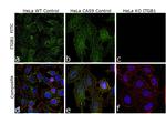 ITGB1 Antibody