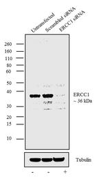 ERCC1 Antibody in Western Blot (WB)