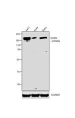 EGFR Antibody in Western Blot (WB)