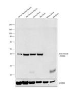 Actin Muscle Antibody in Western Blot (WB)