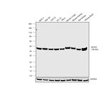 eIF4A1 Antibody in Western Blot (WB)