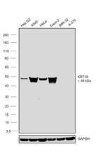 Cytokeratin 18 Antibody