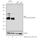 Myeloperoxidase Antibody