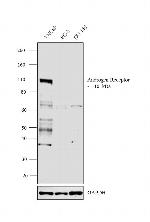 Androgen Receptor Antibody in Western Blot (WB)