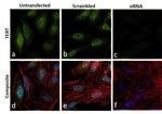 TERT Antibody