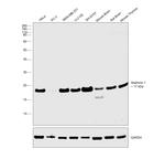 Stathmin 1 Antibody in Western Blot (WB)