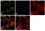 VCAM-1 Antibody in Immunocytochemistry (ICC/IF)