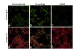 Huntingtin Antibody