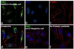 PMEL Antibody in Immunocytochemistry (ICC/IF)