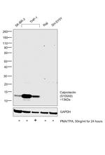 Calprotectin Antibody in Western Blot (WB)