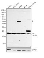 Cofilin Antibody in Western Blot (WB)