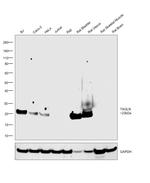 TAGLN Antibody in Western Blot (WB)