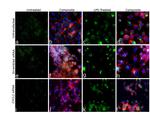 CXCL2 Antibody