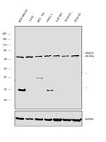HDAC9 Antibody in Western Blot (WB)