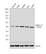 hnRNP H1 Antibody in Western Blot (WB)