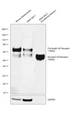 IL-6 Receptor Antibody in Western Blot (WB)