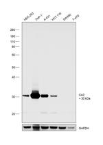 Carbonic Anhydrase II Antibody