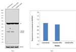 CK2 beta Antibody in Western Blot (WB)