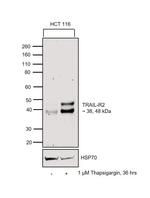 TRAIL-R2 (DR5) Antibody