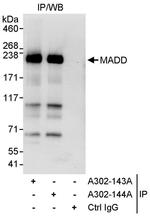 MADD Antibody in Immunoprecipitation (IP)