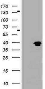 MAGEB1 Antibody in Western Blot (WB)