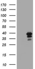 MAGEB18 Antibody in Western Blot (WB)