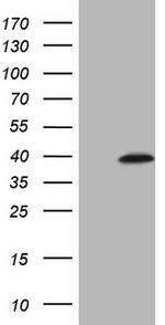 MAGEB3 Antibody in Western Blot (WB)