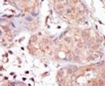 MAK Antibody in Immunohistochemistry (IHC)