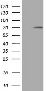 MAK Antibody in Western Blot (WB)