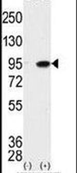 MAK Antibody in Western Blot (WB)