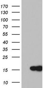 MAP1LC3A Antibody in Western Blot (WB)