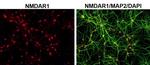 MAP2 Antibody in Immunocytochemistry (ICC/IF)