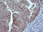 MAP2K1 Antibody in Immunohistochemistry (Paraffin) (IHC (P))