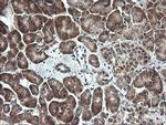 MAP2K1 Antibody in Immunohistochemistry (Paraffin) (IHC (P))