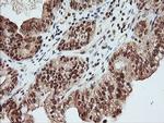 MAP2K1 Antibody in Immunohistochemistry (Paraffin) (IHC (P))