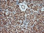 MAP2K1 Antibody in Immunohistochemistry (Paraffin) (IHC (P))