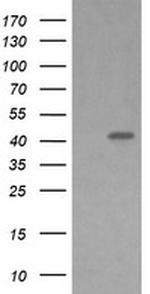 MAP2K1 Antibody in Western Blot (WB)